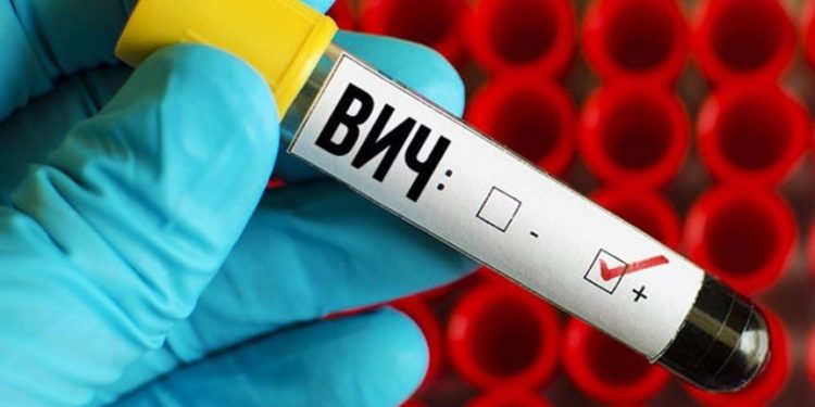 Исследование оценки доступа к профилактике и лечению ВИЧ