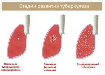 Индикаторы риска туберкулёза среди людей, употребляющих наркотики