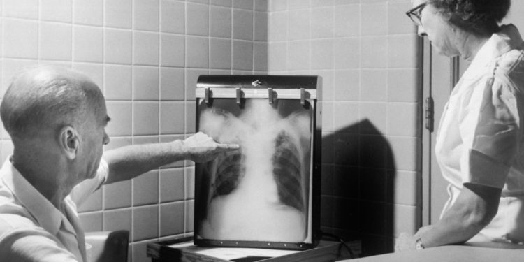 Исследование по оценке доступа людей, употребляющих наркотики, к эффективному лечению туберкулеза